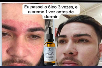NATUOZ - ÓLEO OZONIZADO