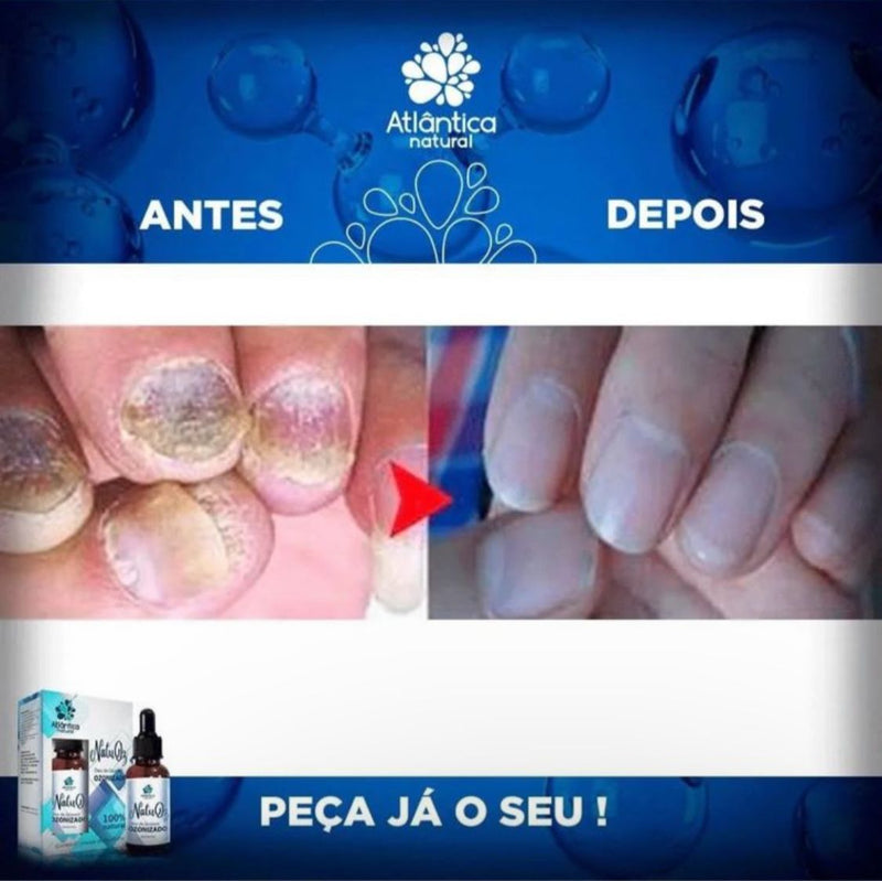 NATUOZ - ÓLEO OZONIZADO