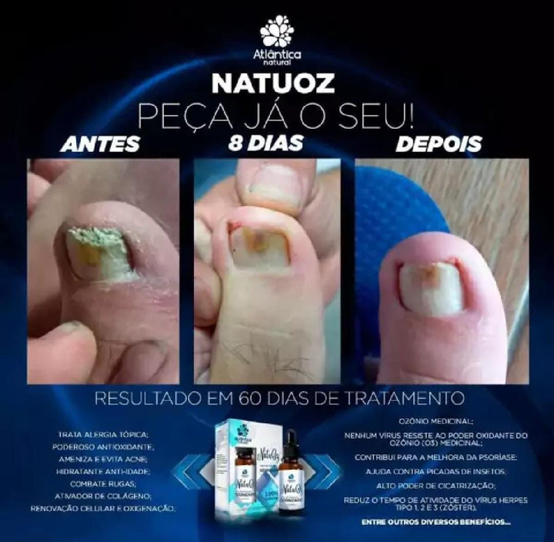 NATUOZ - ÓLEO OZONIZADO