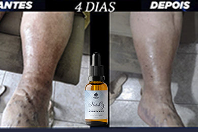 NATUOZ - ÓLEO OZONIZADO